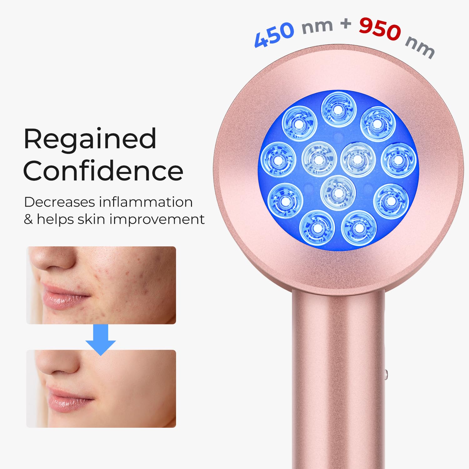 Hautpflege Rot Licht Therapie  – Galvanic Skin Sensor Bewertung und Preis